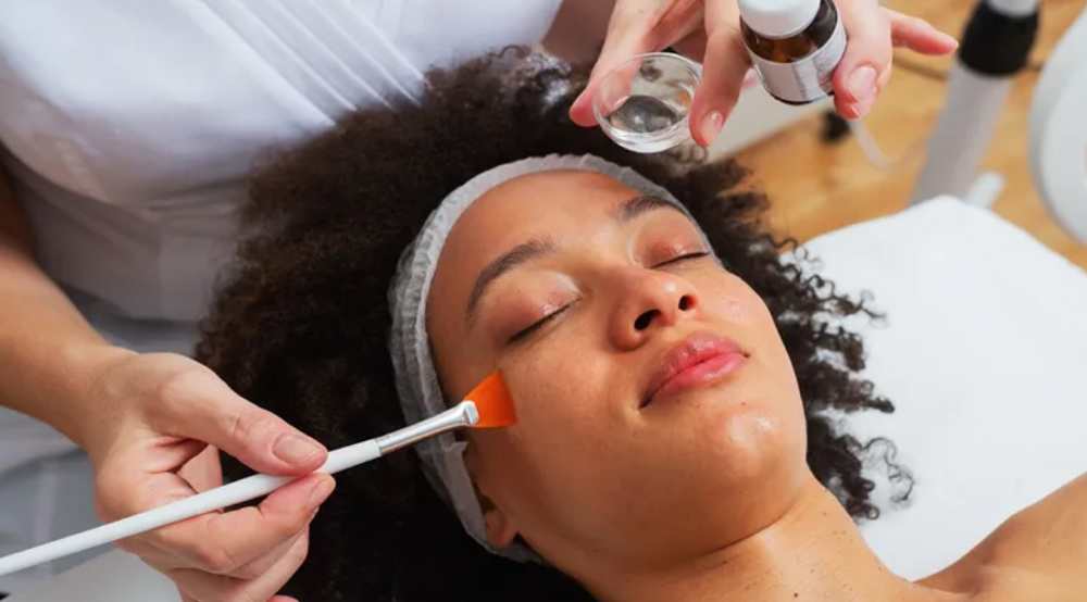 Chemical Peel  (COMING SOON)