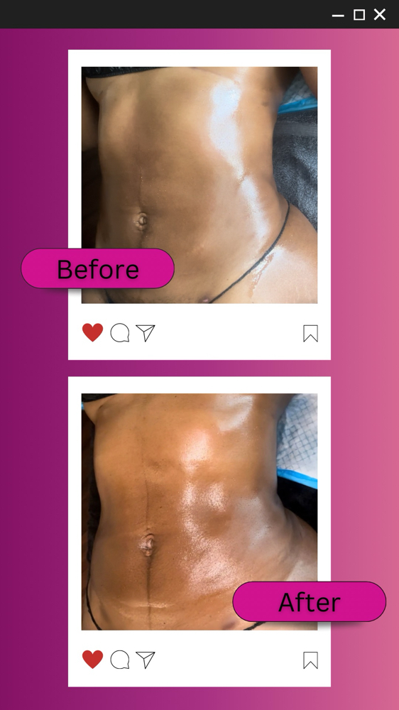 Lymphatic Pack 3