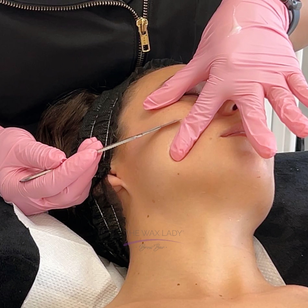 Dermaplaning Treatment