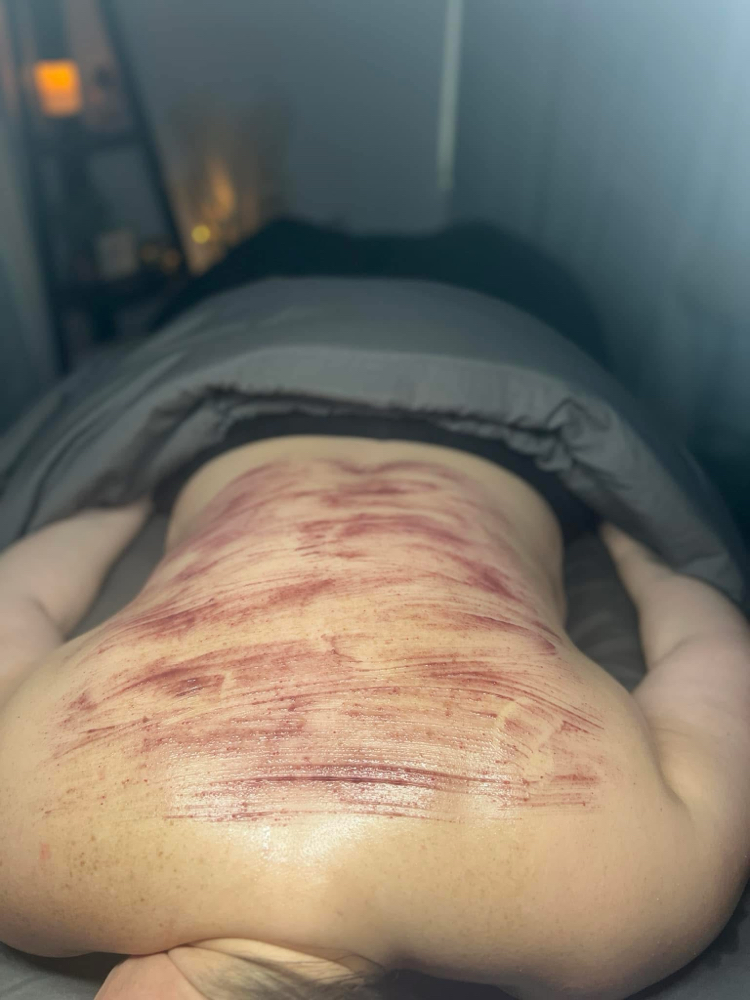Customized Back Facial