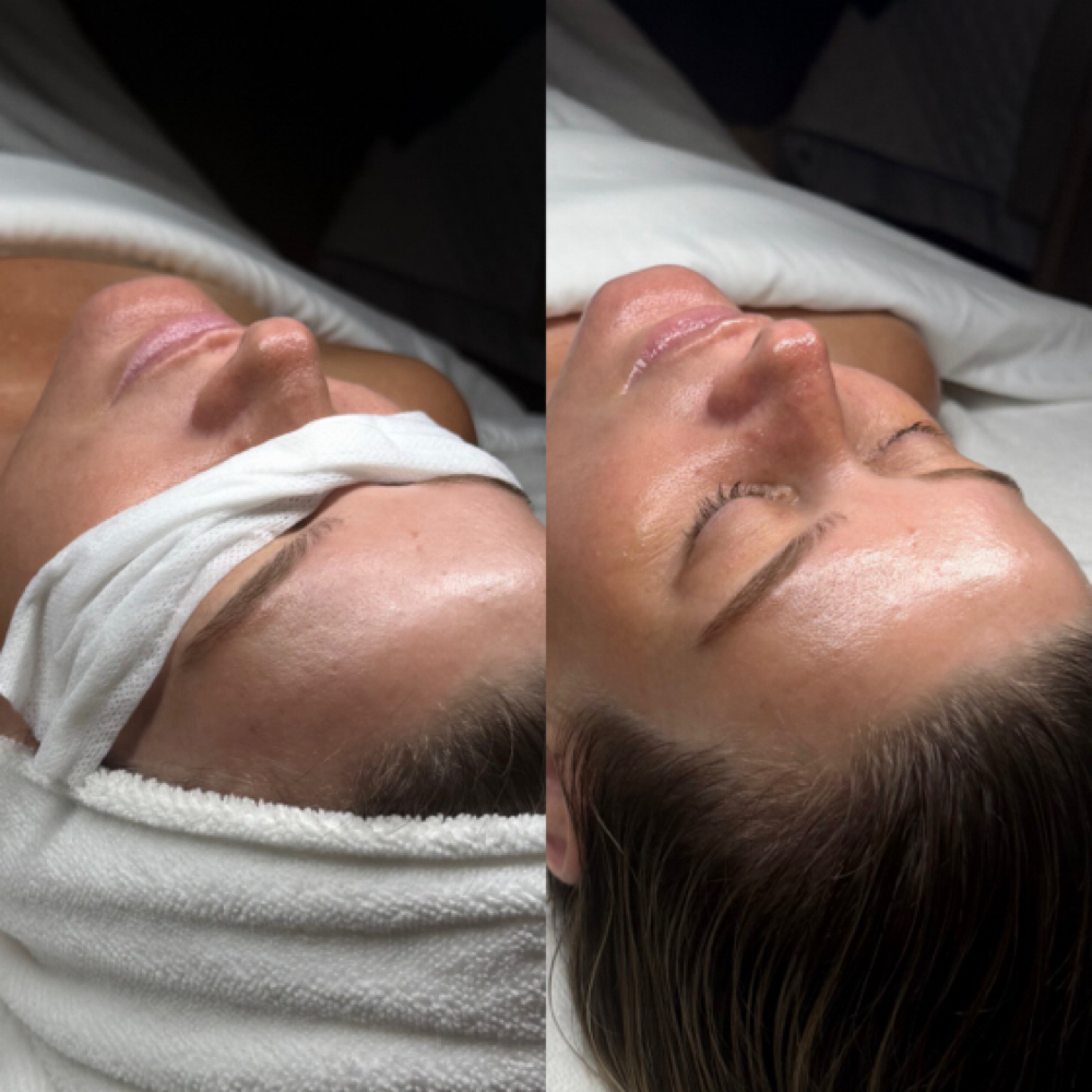 Add-On: Oxygen Infusion at soulestial in Daly City, CA
