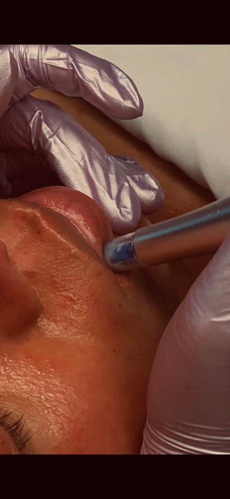 Nano Eyes & Lip Enhancement