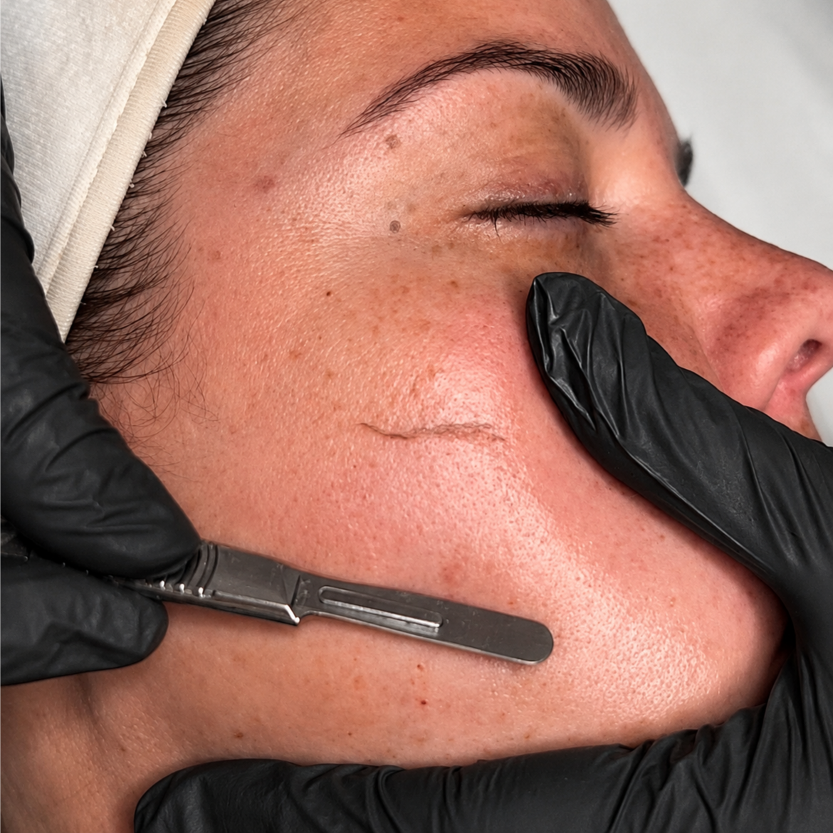 Dermaplane Pro Ageless Facial at Breeze Spa in Myrtle Beach, SC