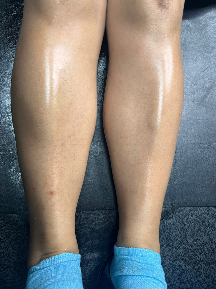 Lower Leg Wax