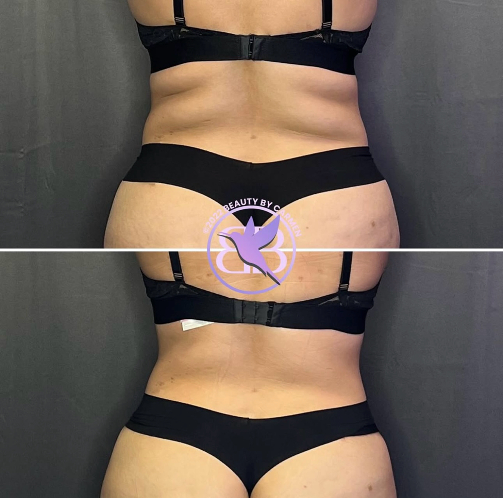 2 Hour Body Sculpting Session