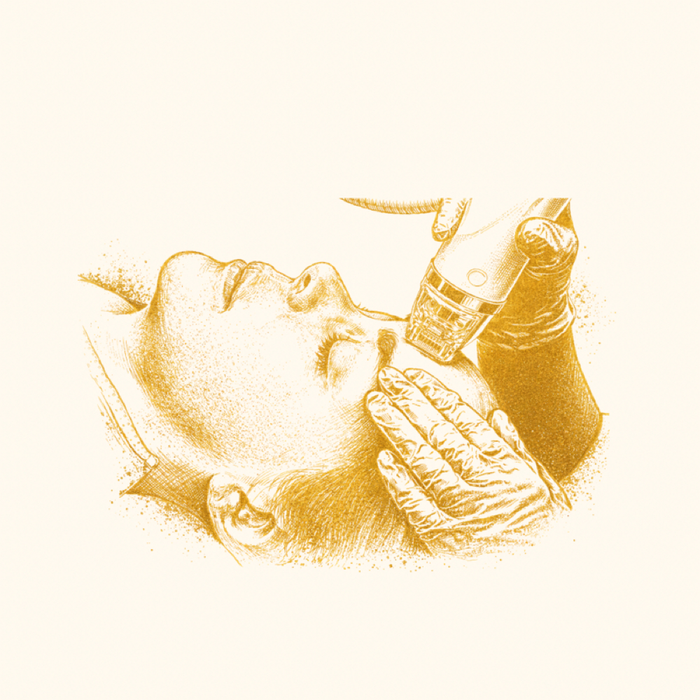 RF Microneedling at RoCo Aesthetics & Wellness in Mayodan, NC