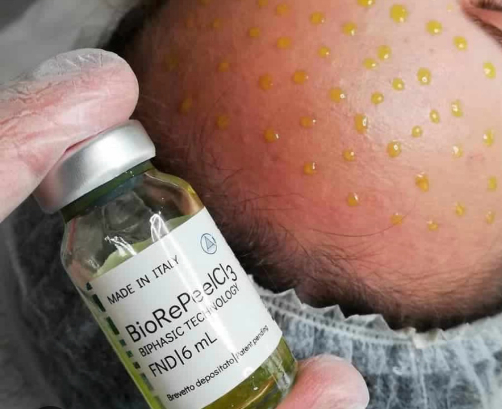 BioRePeel