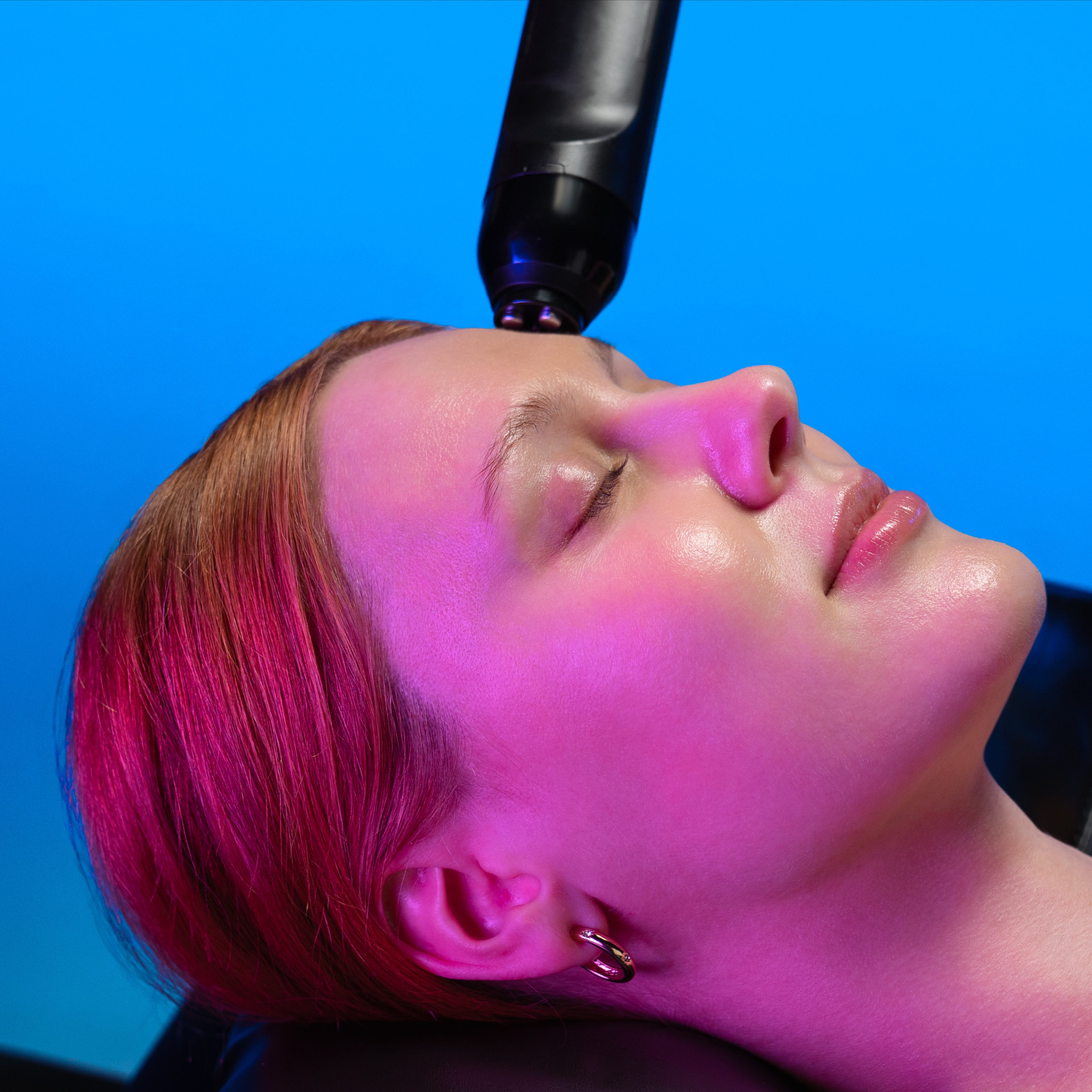RADIOFREQUENCY-STAND ALONE at FaceMe Skin Care in Bloomingdale, IL