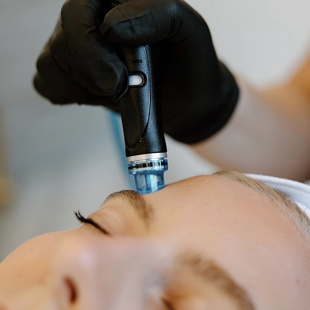 Hydrafacial Go & Glow