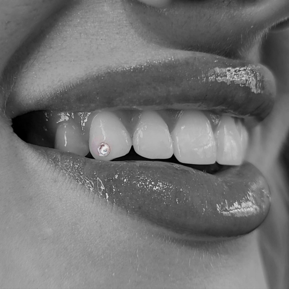 Tooth Gem: 1 Swarovski Gem at The Neon Door in Tucson, AZ