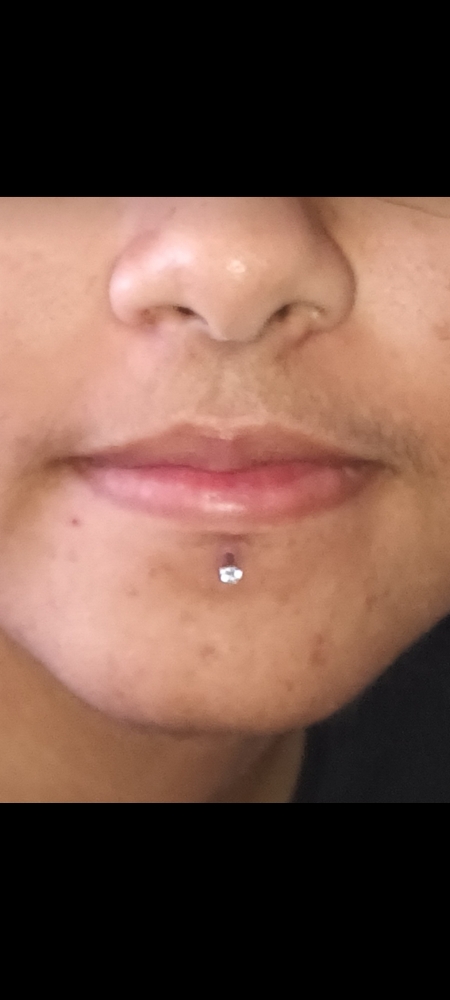 Labret