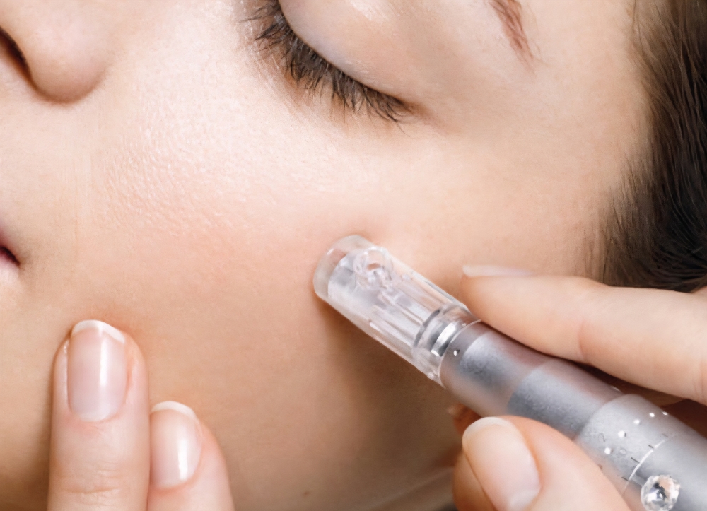 Microneedling