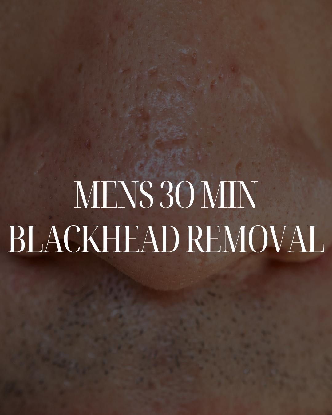 30 Min Blackhead Removal Facial