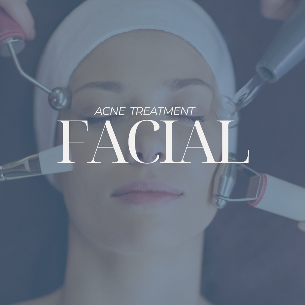 ACNE TREATMENT