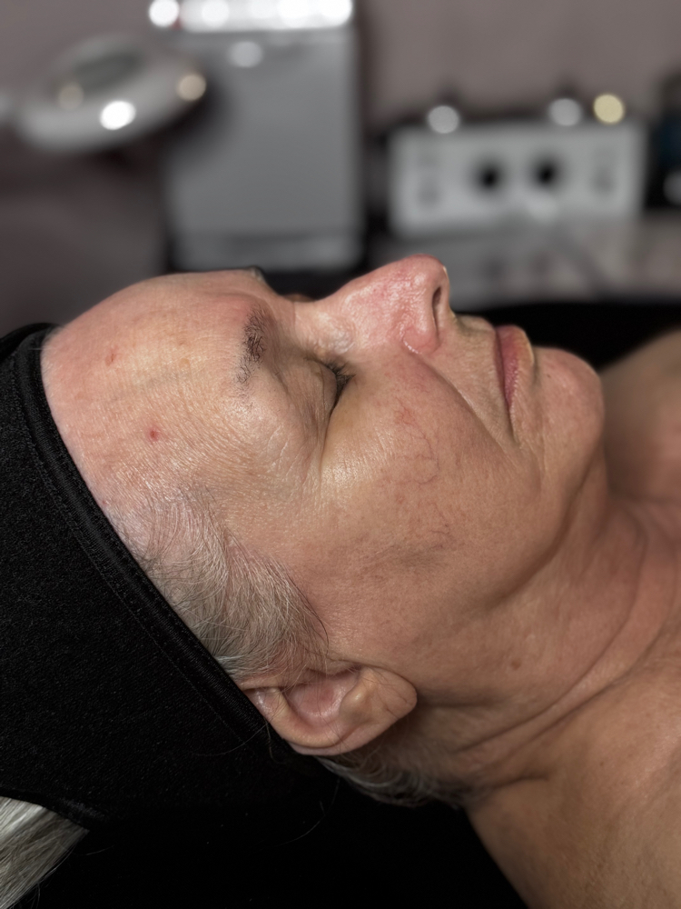 Enzyme and Oxygen Facial
