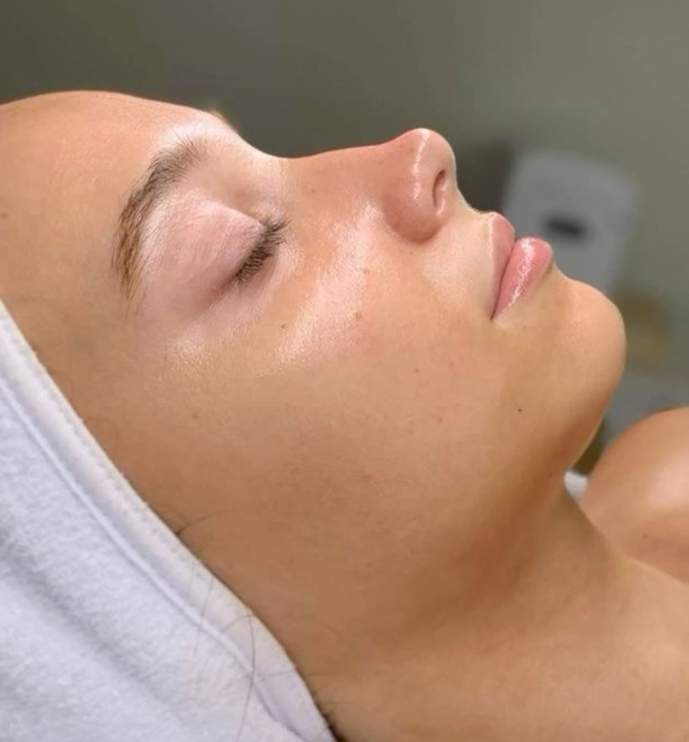 Chemical Peel at KB Artistry Studio in Mesa, AZ
