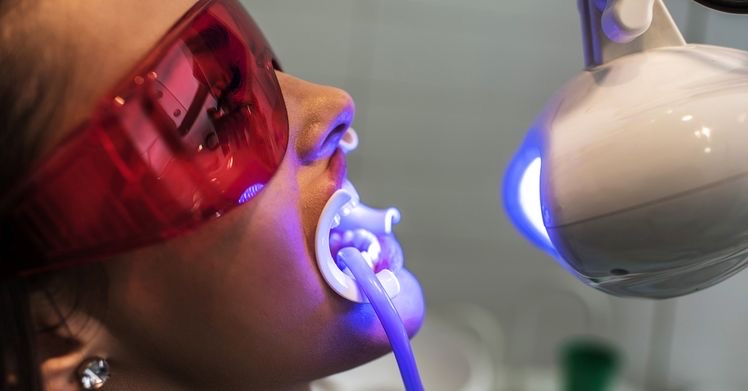 LED Teeth Whitening