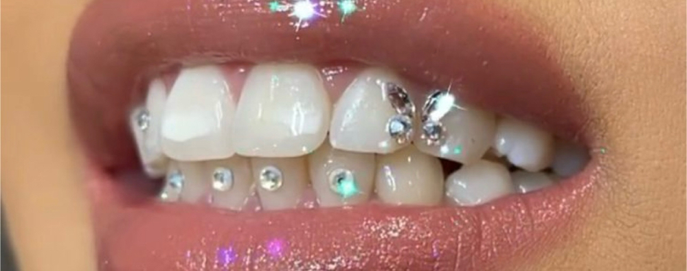 Tooth Gems Swarovski