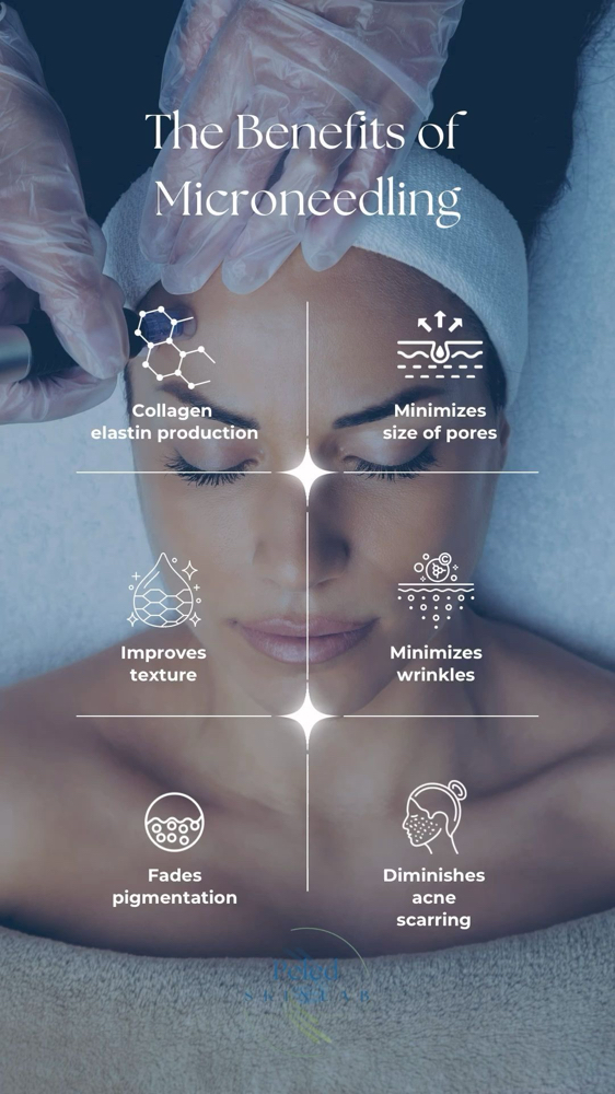 Flawless Beauty MicroneedlingTrial