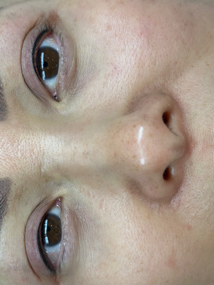 Lash Line Enhancement (Upper)
