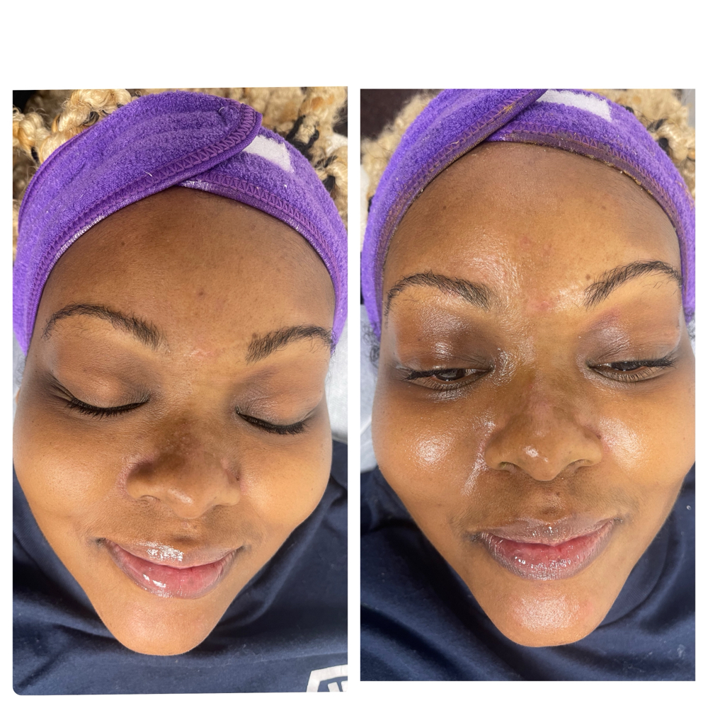 24K SKIN TREATMENT