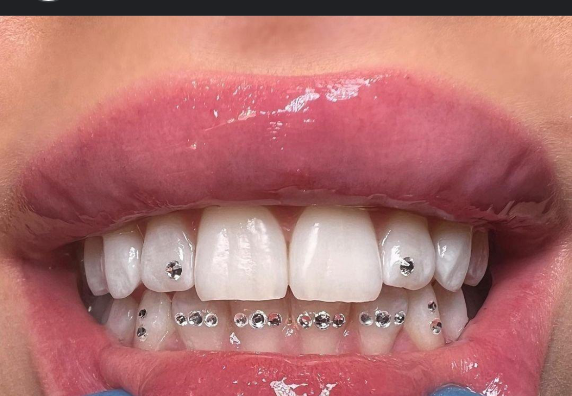 Single Tooth Gem