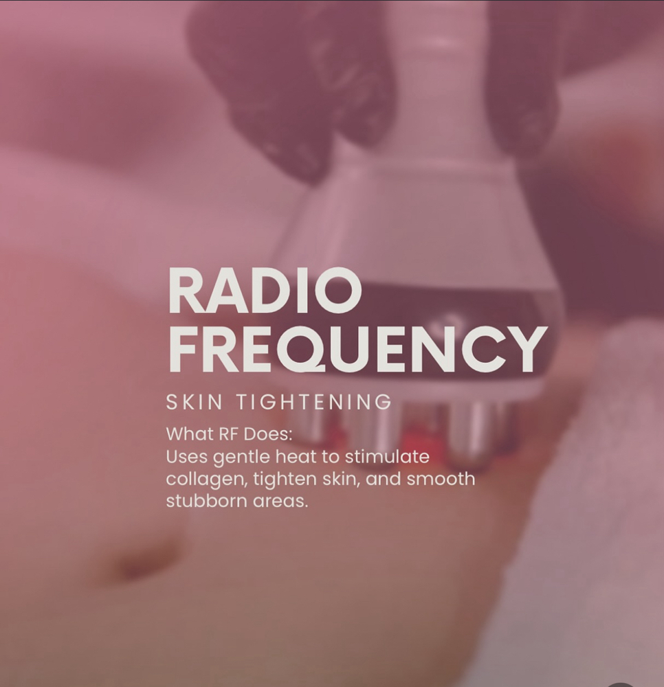 Skin Tightening This Week Only