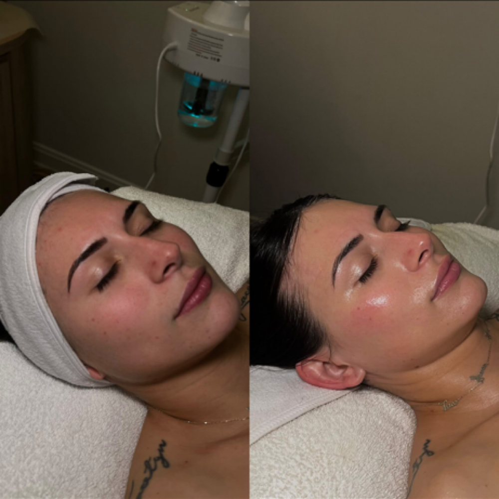 Blanace + Restore Facial at Bare Beauty By Alexis in Bay Saint Louis, MS