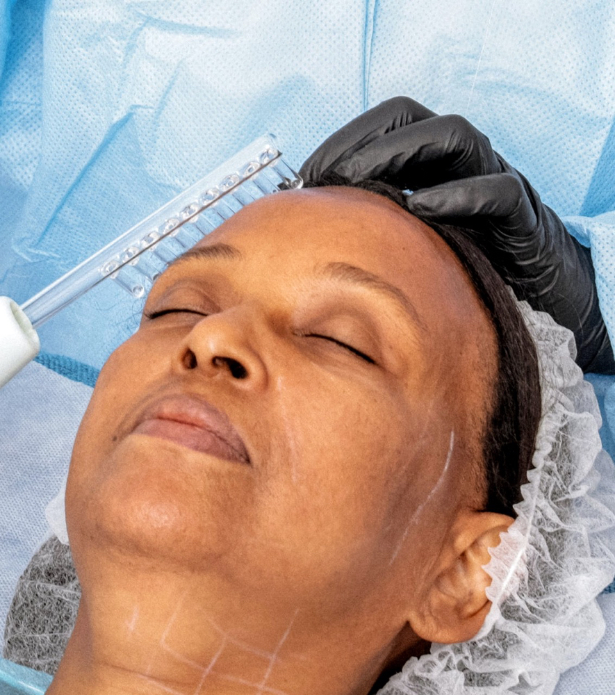 High Frequency Argon/Neon Facial