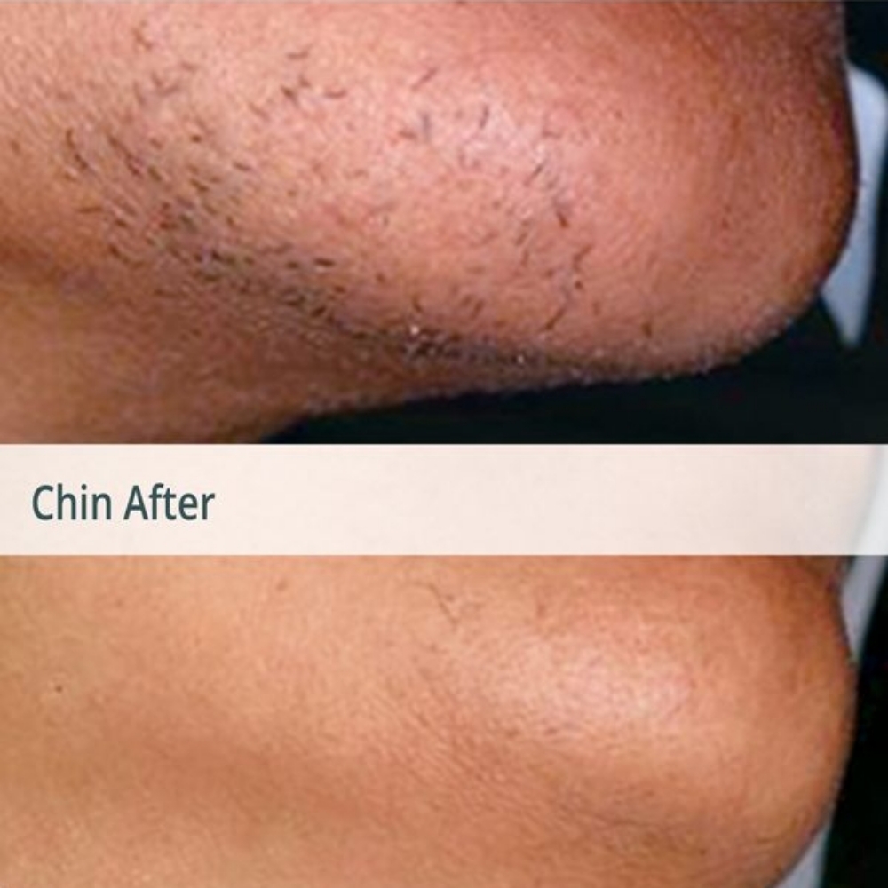 CHIN WAX at Southern Styles Salon & Spa, LLC in Ludowici, GA