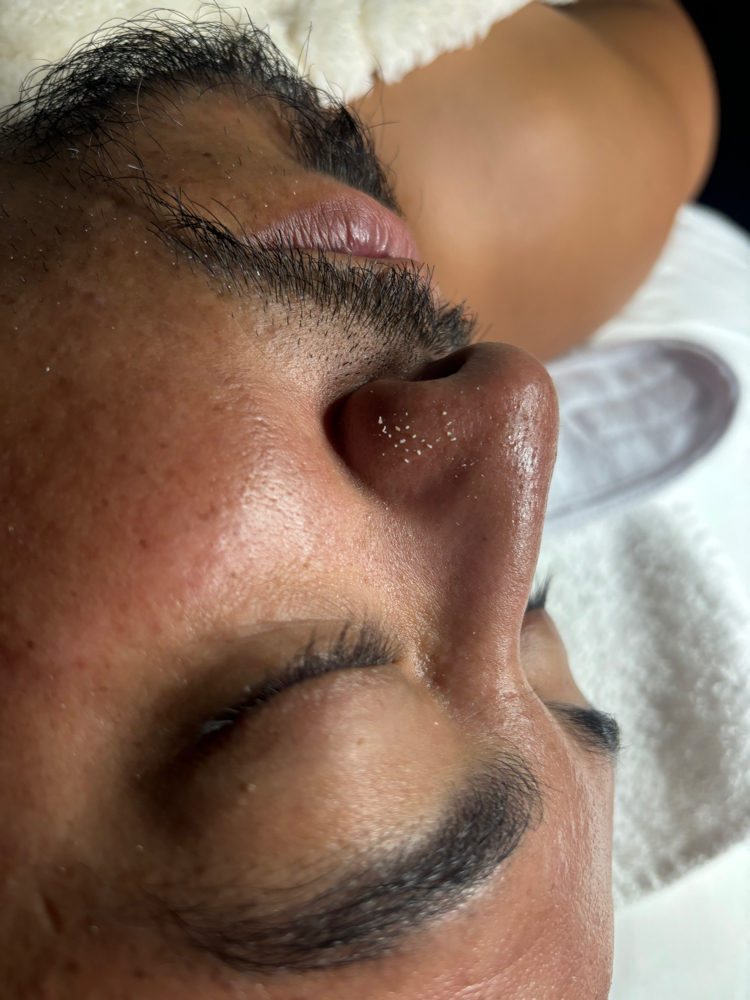 Deep Pore Facial at YG Aesthetics in Chicago, IL
