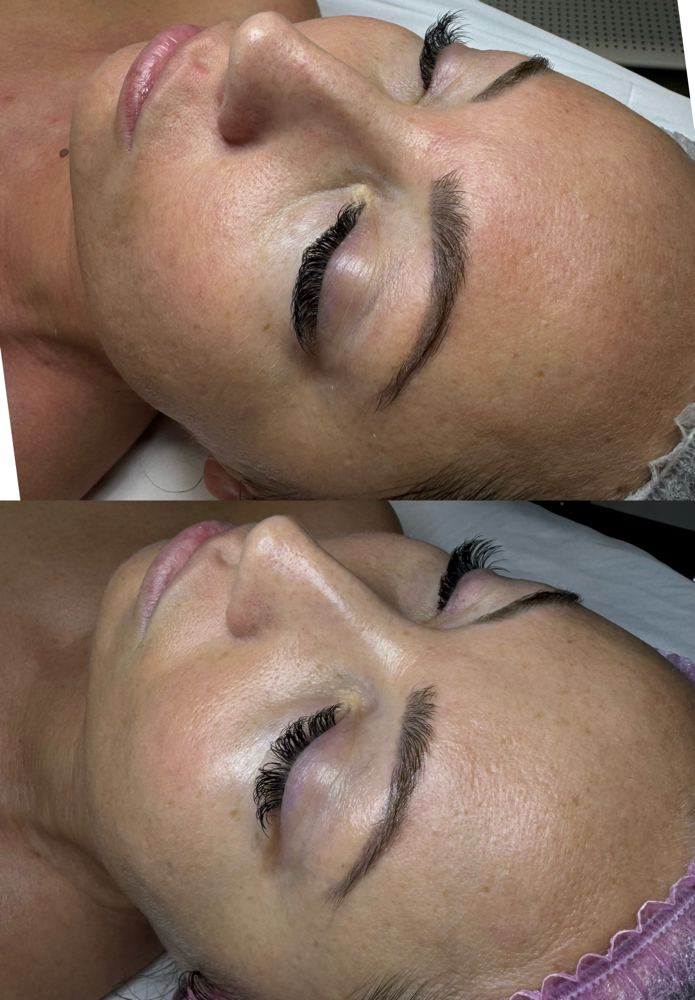 Instant Glow at Healthy skin by Alvina in Highland Park, IL