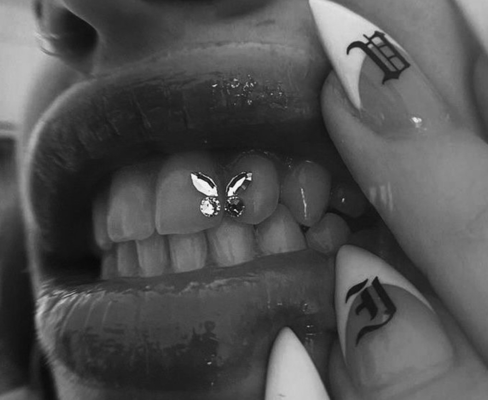 Tooth Gem ( Butterfly )