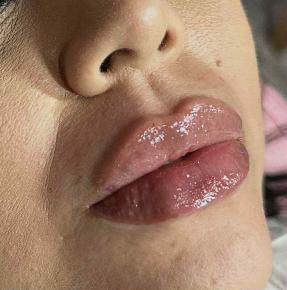 OG Plump (Lip Filler 1.1ml) at Kissable Curves in TX, TX