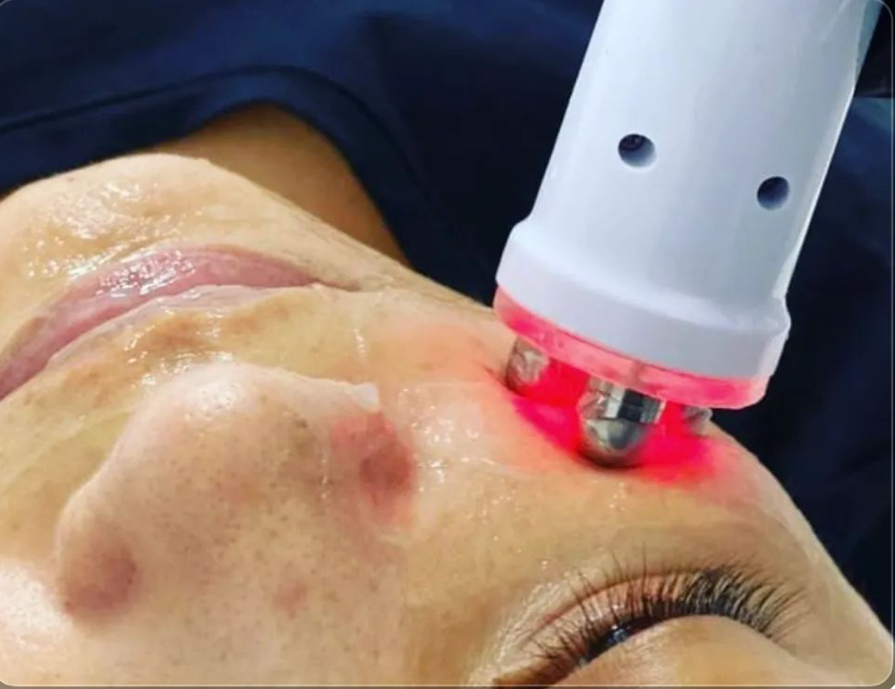 Doubble Chin Remover Treatment