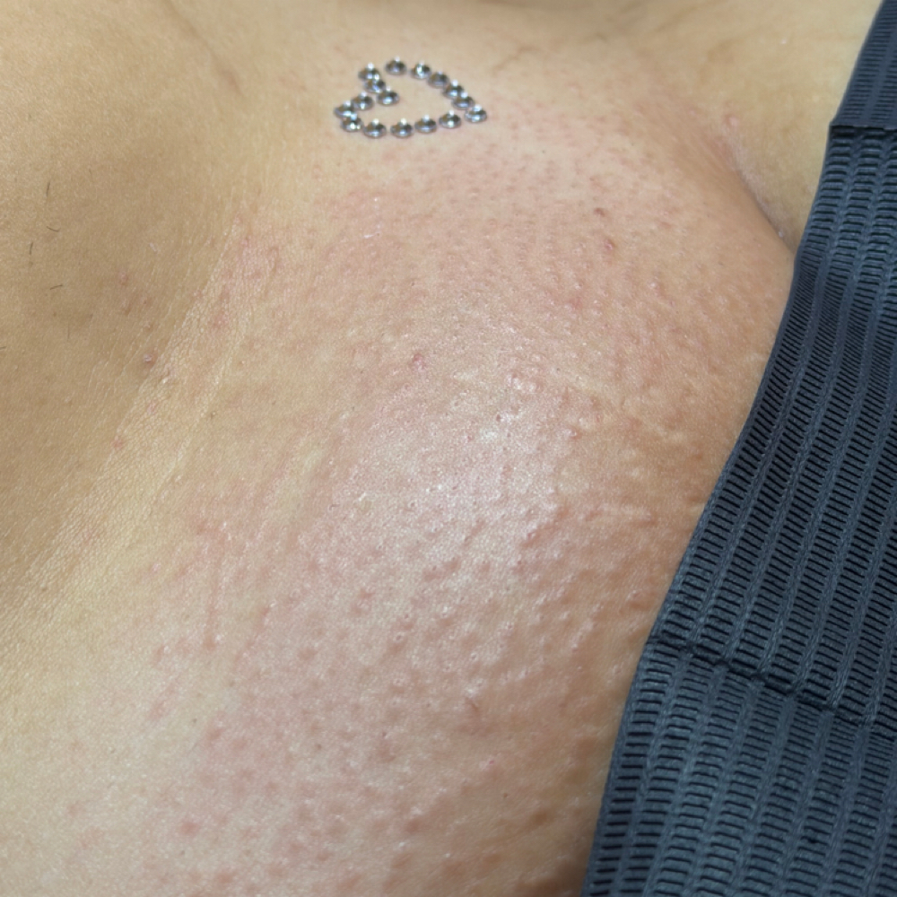 First Time Client : Brazilian Wax at Crista Skin Studio in Lake Mary, FL