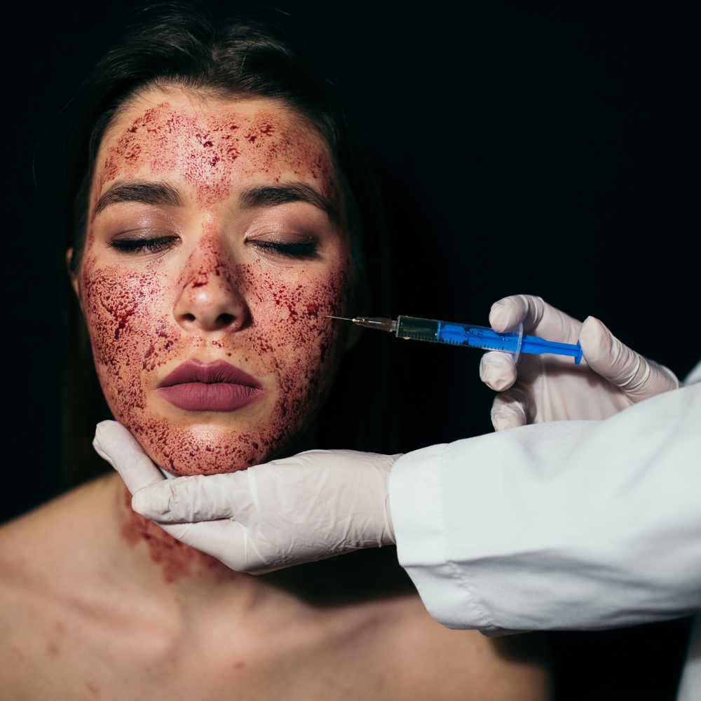 PRP "Vampire" Facial
