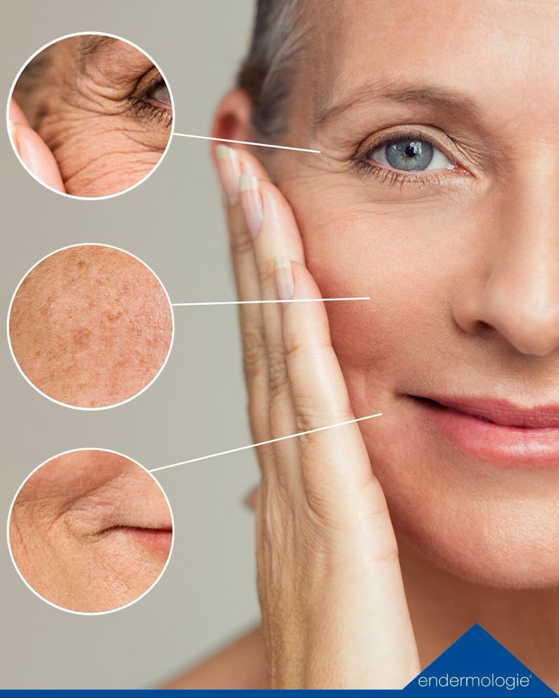 Anti-aging basic