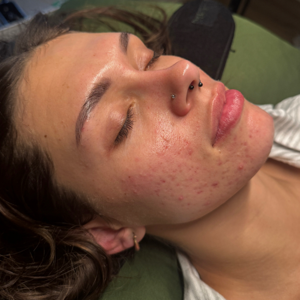 The Refinery Skincare Plan at Skin Refinery in Ozark, MO