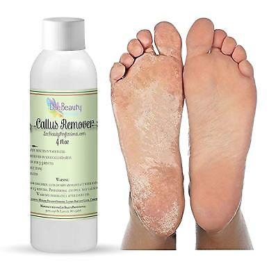 Add On Callus Remover