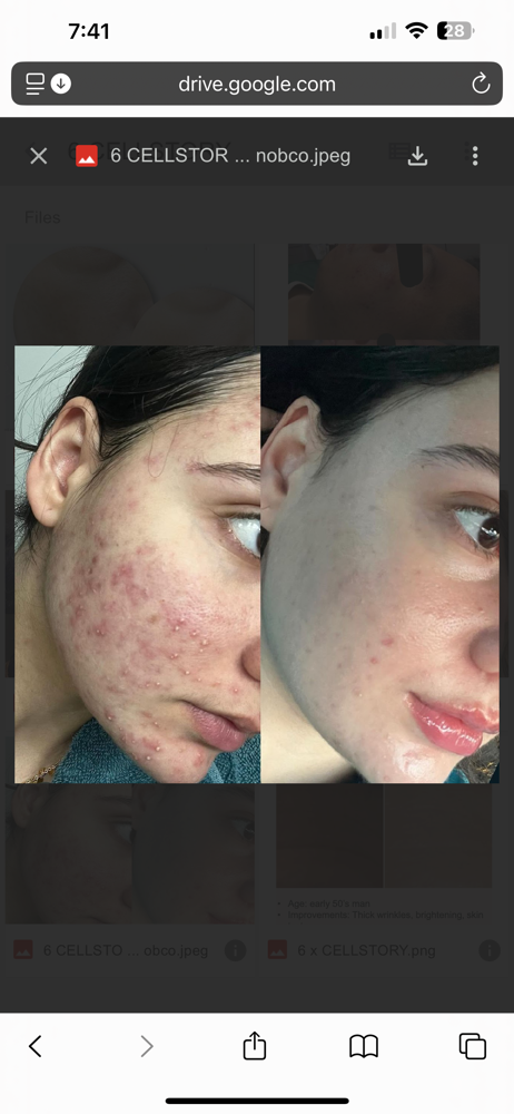 Cell Story Liquid Microneedling