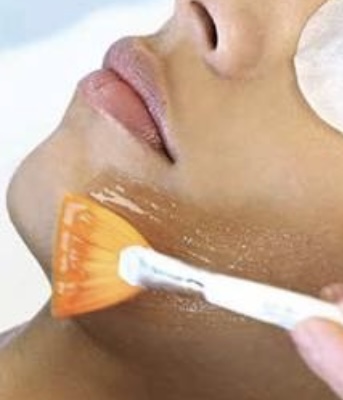 Dermaplaning With Enzyme Peel at BluEssence Aesthetics & Spa in Martinsville, VA