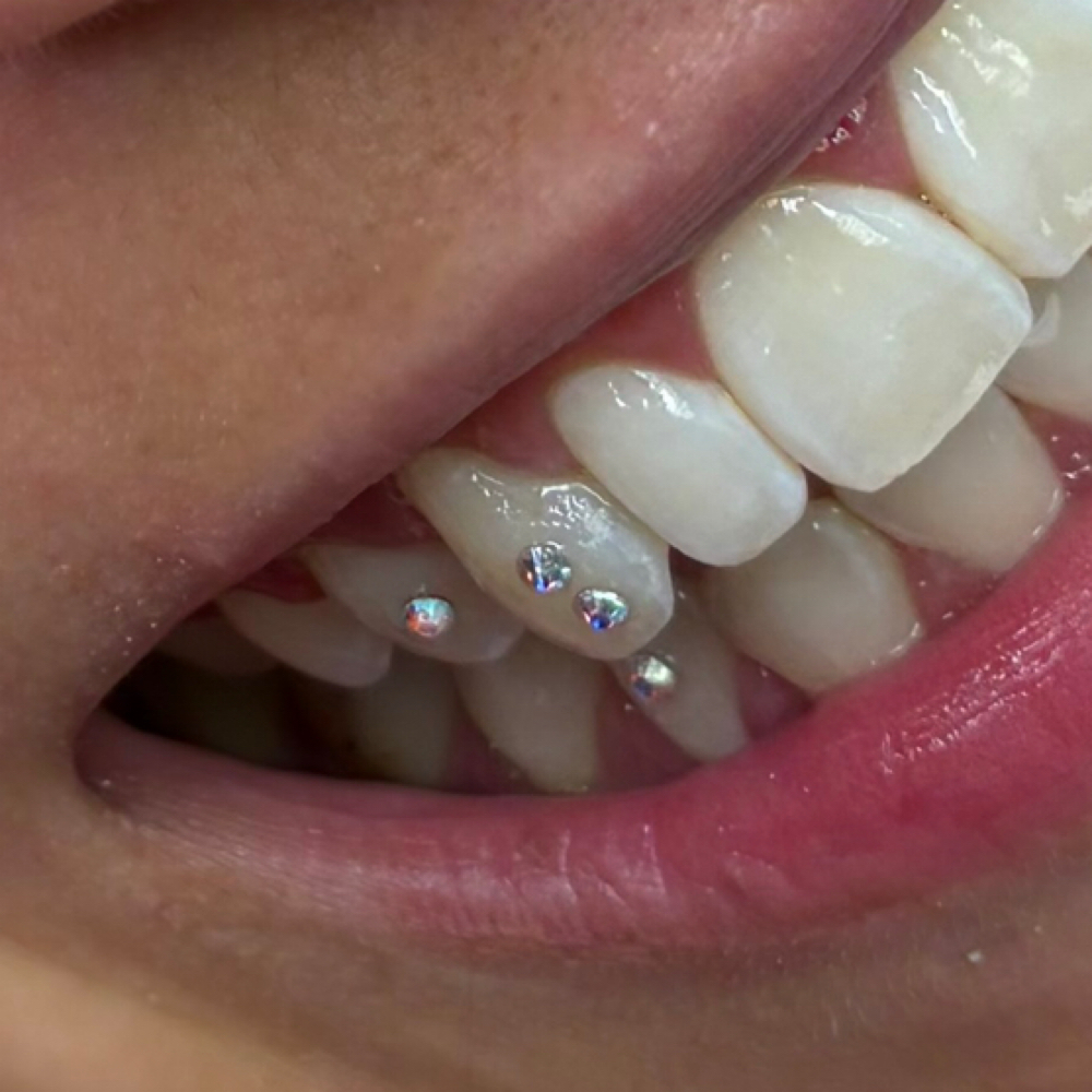 Tooth Gems at Rad Brows and More in Boise, ID