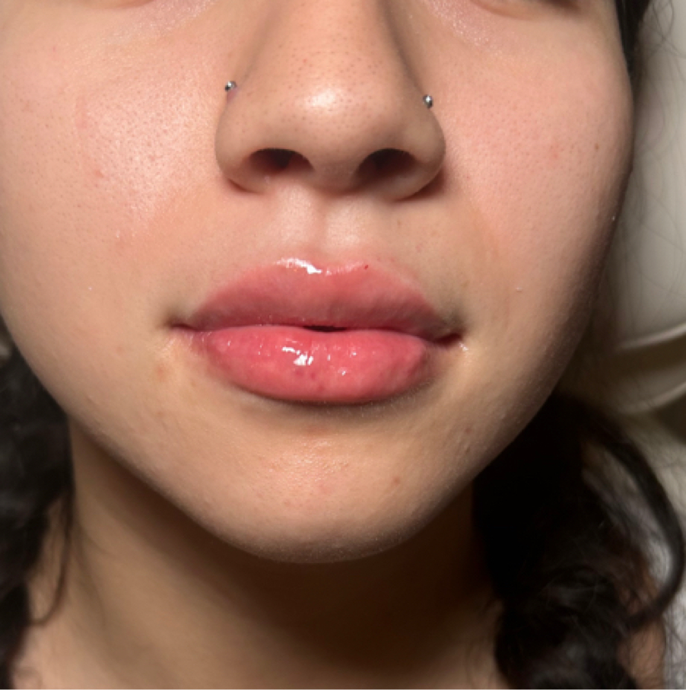 🇺🇸JULY LIP SPECIAL 🇺🇸 at Rewind Health & Aesthetics LLC in San Marcos, TX