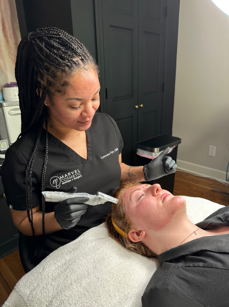 Dermaplane Facial