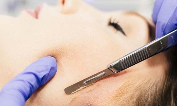 Dermaplane Glow Facial