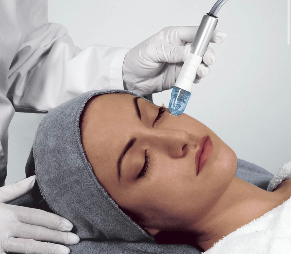 Microdermabrasion Facial