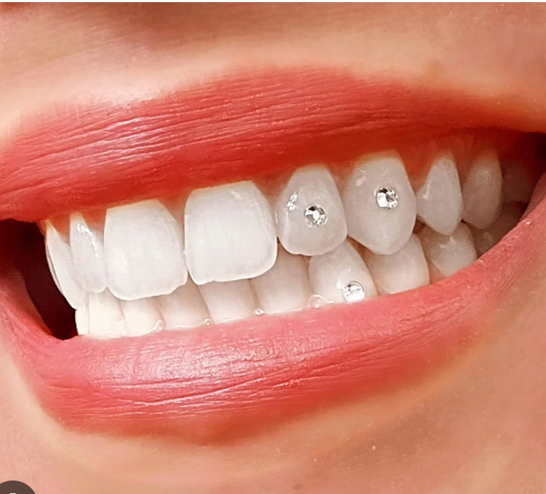 Tooth Gem