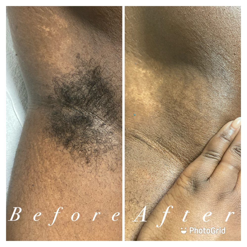 Underarm Wax