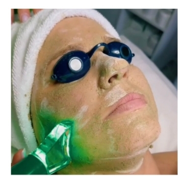 90 Min Corrective Facial